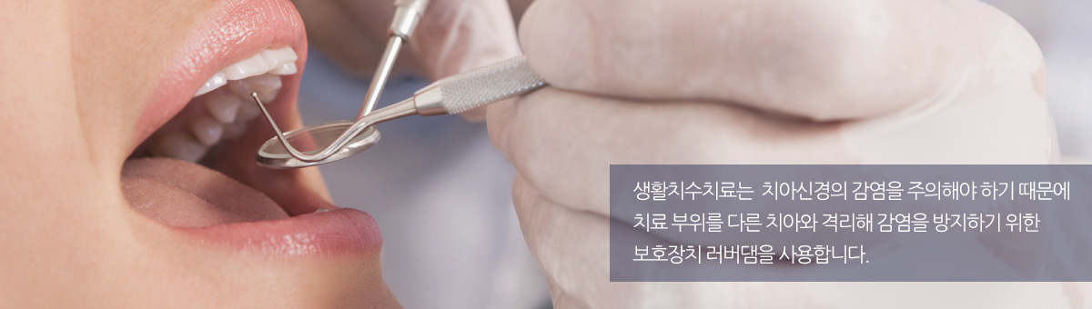 생활치수치료는  치아신경의 감염을 주의해야 하기 때문에 치료 부위를 다른 치아와 격리해 감염을 방지하기 위한 보호장치 러버댐을 사용합니다.